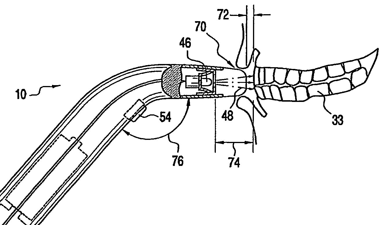 patent